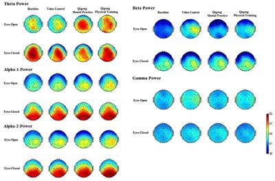 EEG Brain Activity in Dynamic Health Qigong Training: Same Effects for Mental Practice and Physical Training?